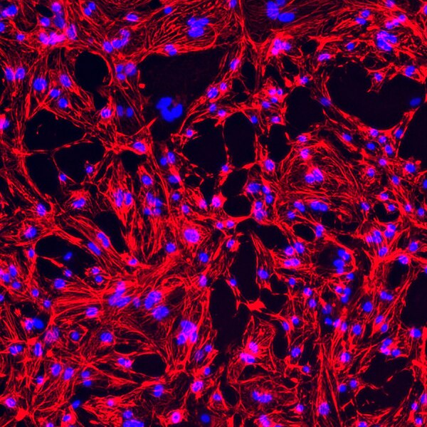 Immunofluorescent image of Rhesus macaque iPSC-derived cardiomyocytes labeled with DSHB antibody CT3 against troponin T (cardiac/slow) (red). Image Credit: Yongshun Lin. PMID: 38843830, Fig. S1C.